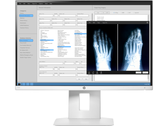 foot x-rays